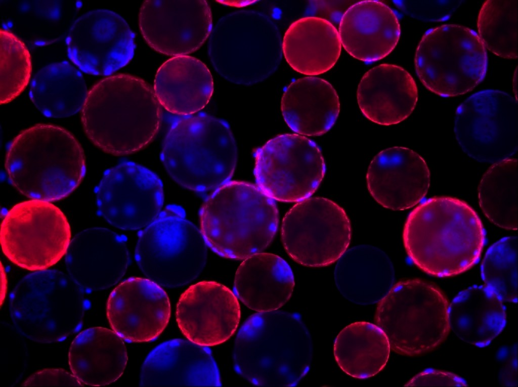 Raumeninės ląstelės (nudažytos mėlynai) ant karkaso – raudonai nudažytų rutuliukų. Ideali figūra auginti ląstelėms dėl didelio paviršiaus ploto