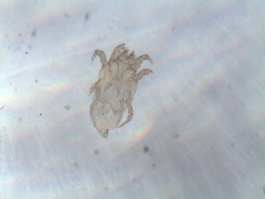 2 pav. D.pteronyssinus erkė po mikroskopu ( padidinta 300x) (Nuotr. magistrantės V.Kazlauskaitės)