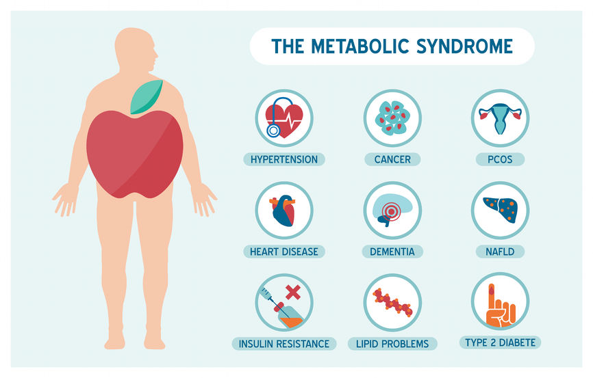 43926688 - the metabolic syndrome infographics with disease medical icons, fat male body and apple shape